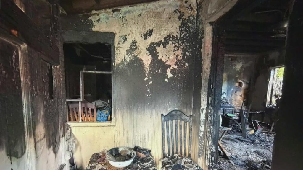 Woman hospitalized after Miami house fire leaves three displaced — CBS Miami, Dallas Health news